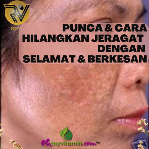 6 PUNCA DAN PETUA HILANGKAN JERAGAT DENGAN BERKESAN