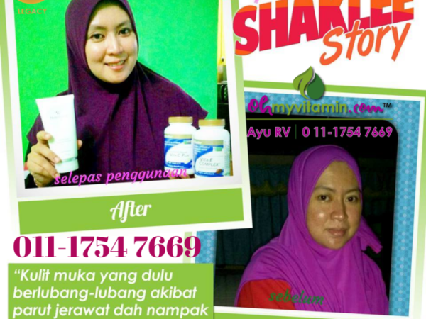 BAGAIMANA CARA HILANGKAN JERAGAT DENGAN CEPAT BERKESAN DAN SELAMAT?