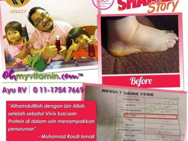 PULIH BUAH PINGGANG BOCOR TANPA PERLU BIOPSI DAN STEROID