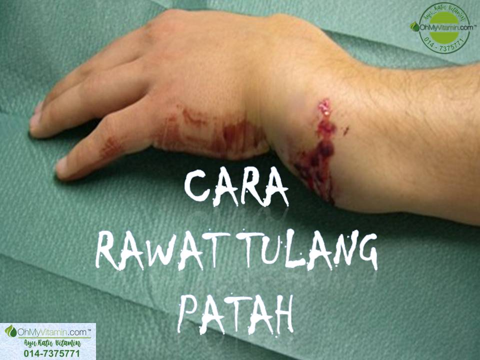 SUPLEMEN UNTUK BANTU RAWAT TULANG PATAH DAN RETAK DENGAN LEBIH CEPAT TANPA RISIKO