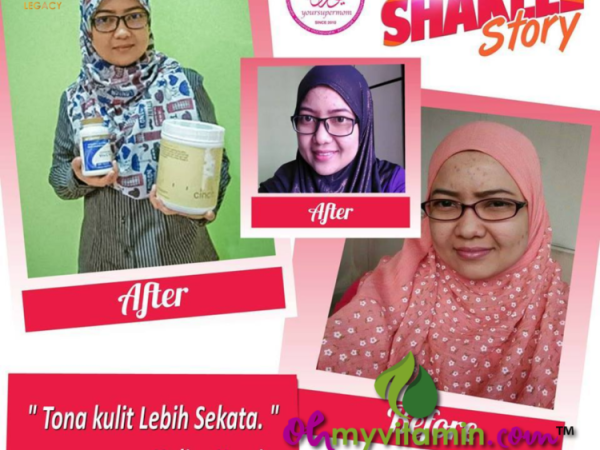 RAWAT KULIT SENSITIF AKIBAT SALAH GUNA PRODUK KECANTIKAN