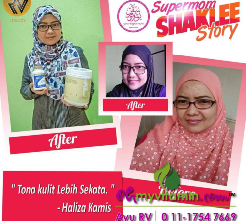TESTIMONI VITAMIN-E PUDARKAN KULIT KUSAM