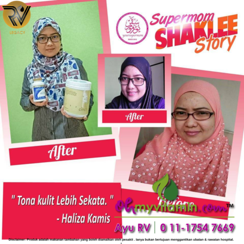 TESTIMONI VITAMIN-E PUDARKAN KULIT KUSAM