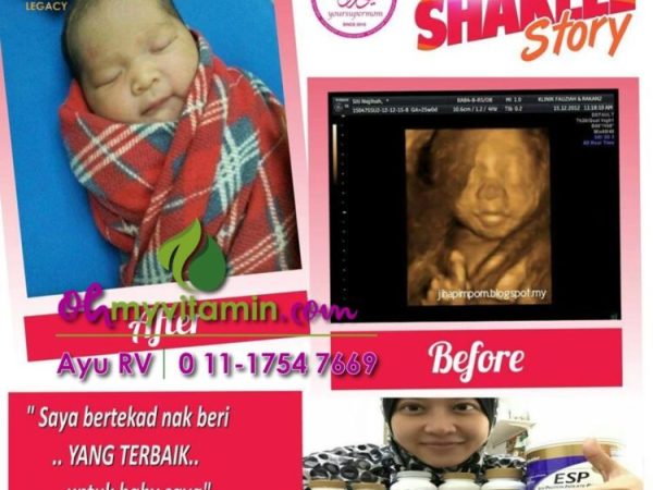 SET HAMIL TERBAIK UNTUK IBU DAN BAYI