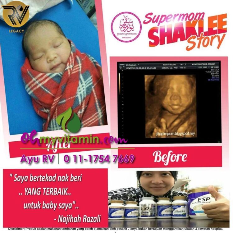 SET HAMIL TERBAIK UNTUK IBU DAN BAYI