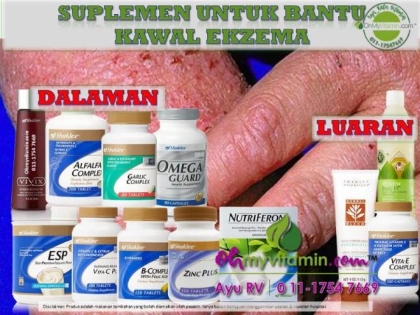 SUPLEMEN BANTU RAWAT EKZEMA? APA ITU EKZEMA? BAGAIMANA RAWAT EKZEMA?