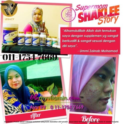 TESTIMONI ALFALFA PENAWAR TERBAIK RESDUNG JERAWAT