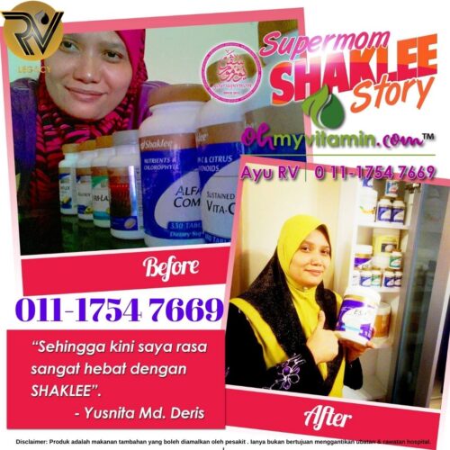 TESTIMONI MIGRAIN TERUK PULIH DALAM MASA 2 HARI