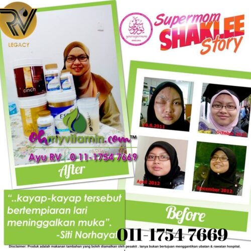 TESTIMONI UBAT KAYAP DENGAN CEPAT DAN SELAMAT