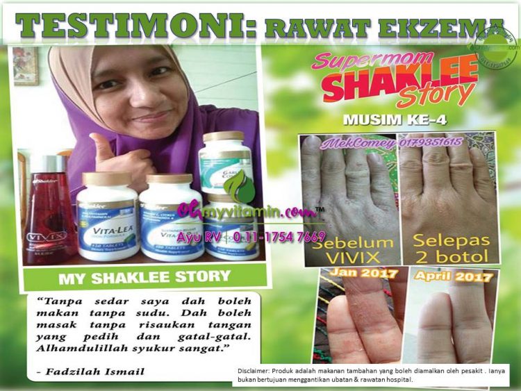 CARA KAWAL EKZEMA AGAR KULIT TAK MELECET TERUK
