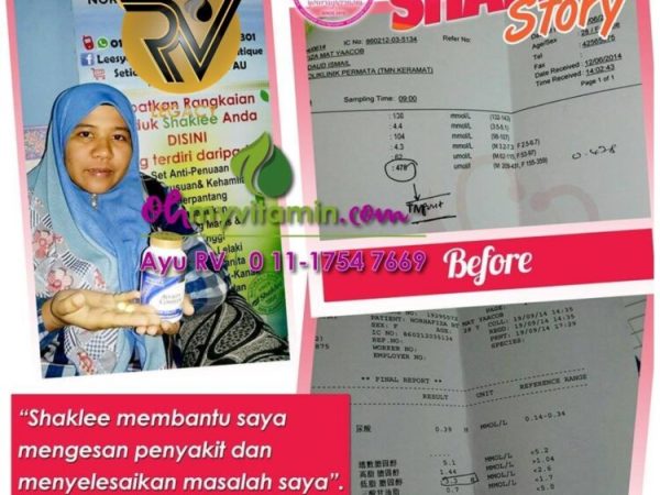 BACAAN ASID URIK GOUT TURUN SELEPAS 3 BULAN AMALKAN INI
