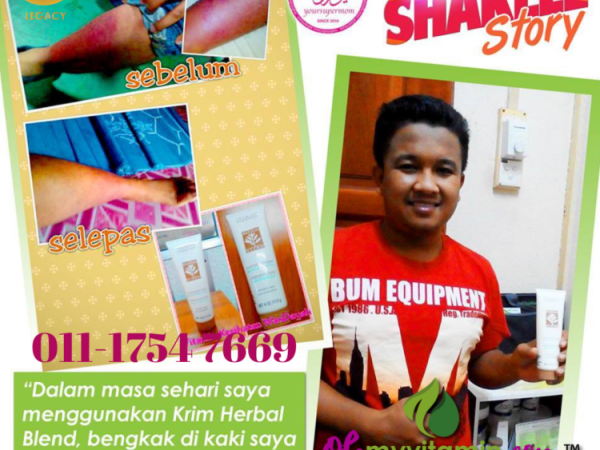 TESTIMONI BENGKAK KAKI SURUT DENGAN KRIM HERBAL BLEND