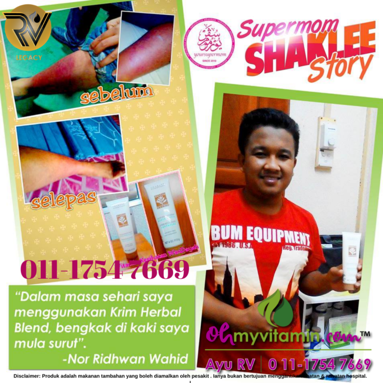 TESTIMONI BENGKAK KAKI SURUT DENGAN KRIM HERBAL BLEND