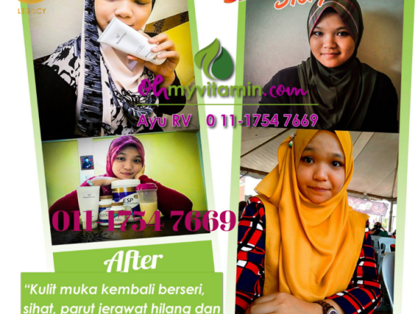TESTIMONI KULIT KUSAM SEMAKIN BERSERI , DARI DALAM DAN LUARAN