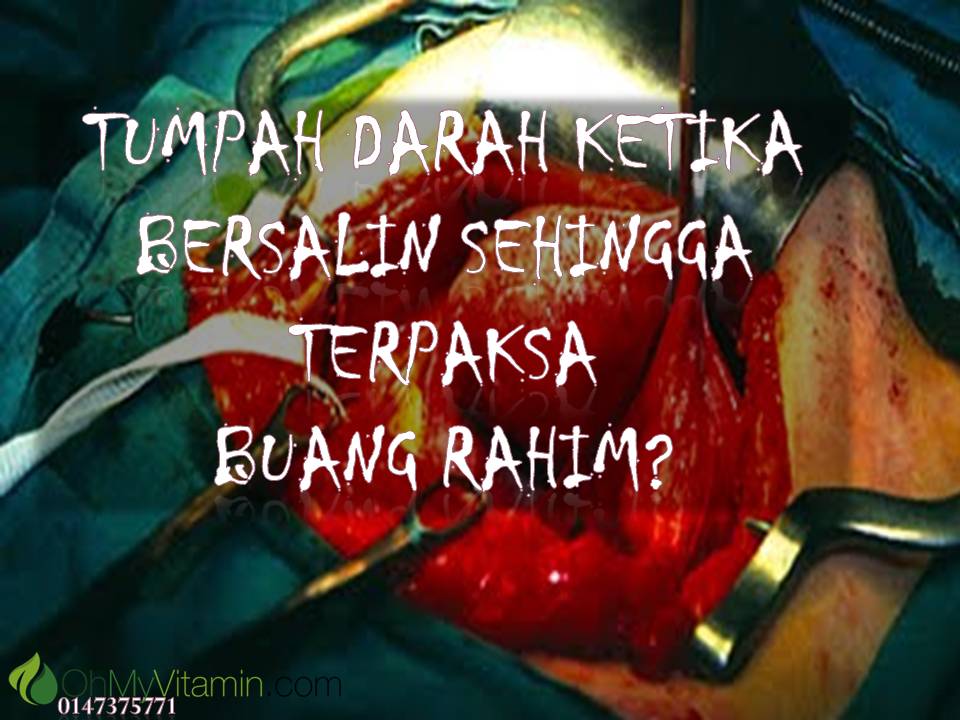 CARA ATASI TUMPAH DARAH KETIKA BERSALIN AKIBAT TAK CUKUP ZAT BESI.