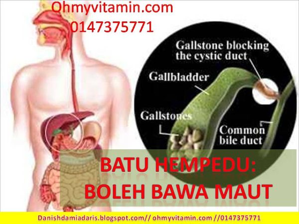 BATU HEMPEDU KETIKA MENGANDUNG, IBU INI NEKAD UNTUK SEMBUH