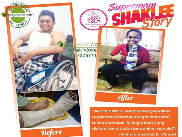 TESTIMONI: SET TULANG PATAH SHAKLEE BANTU RAWAT TULANG PATAH DENGAN LEBIH CEPAT DAN BERKESAN