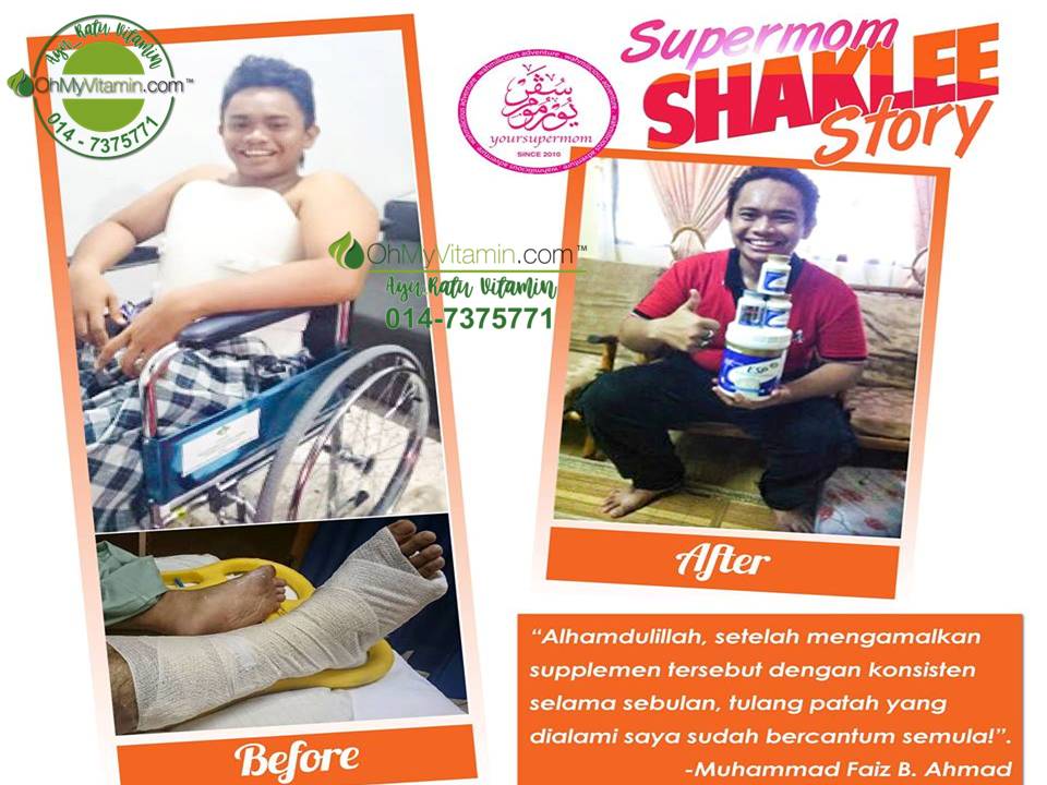 TESTIMONI: SET TULANG PATAH SHAKLEE BANTU RAWAT TULANG PATAH DENGAN LEBIH CEPAT DAN BERKESAN