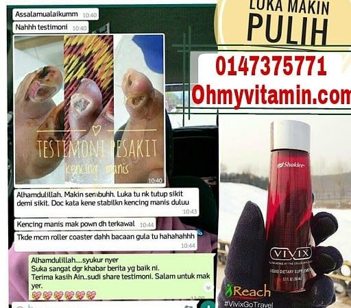 VIVIX: TESTIMONI RAWAT LUKA KENCING MANIS